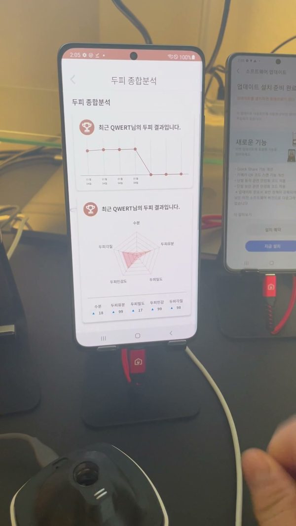 FOLLNIC 앱의 두피 종합 분석 화면